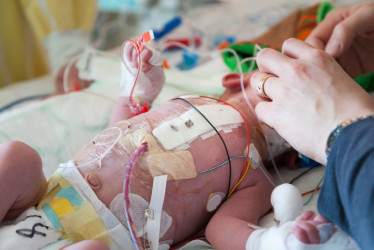 "Alerta en Quindío: 28 muertes perinatales y una materna sacuden al sistema sanitario"