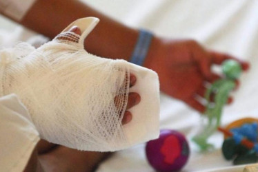 Quemados por pólvora