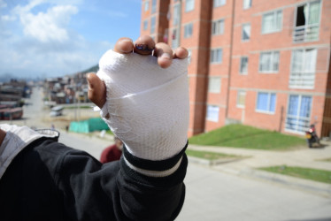 Reporte de lesiones por pólvora en Colombia: menores y adultos, entre los más afectados; conozca las estadísticas