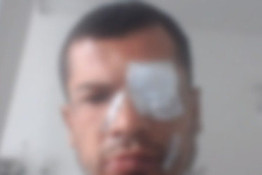 El señalado atendió la audiencia desde un hospital. La mujer, tras las lesiones con machete del 2023, perdió su trabajo, pues las labores eran con sus manos y no se trató de un accidente laboral.