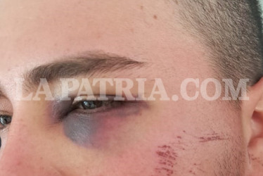 80 puntos de sutura, un ojo afectado y fracturas en el rostro, lo que sufrió el lesionado.