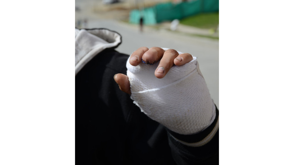 Hasta las chispitas, que parecen inofensivas, son de gran riesgo. Evite su manipulación, podría acabar sin una parte de su cuerpo.