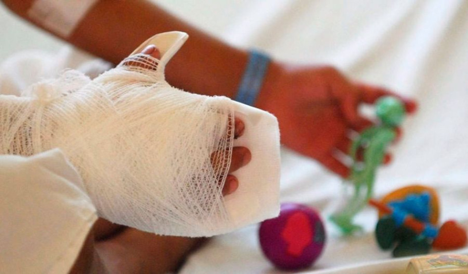 Un niño de dos años y un adulto de 30 resultaron quemados por pólvora en Salamina