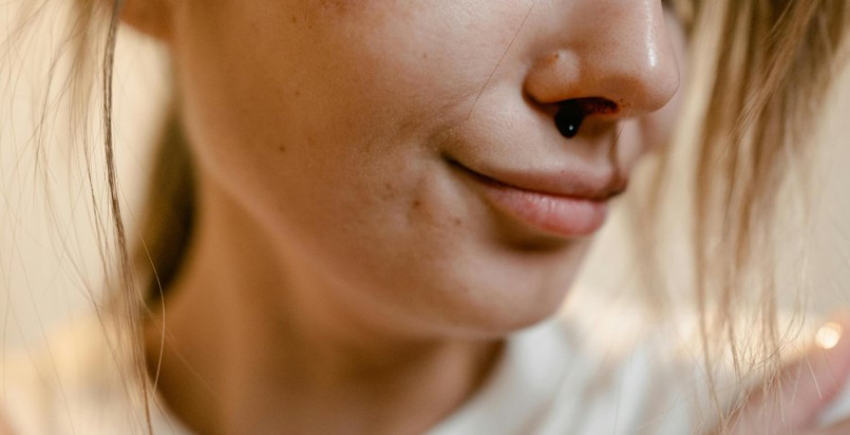 Sangrado por la nariz