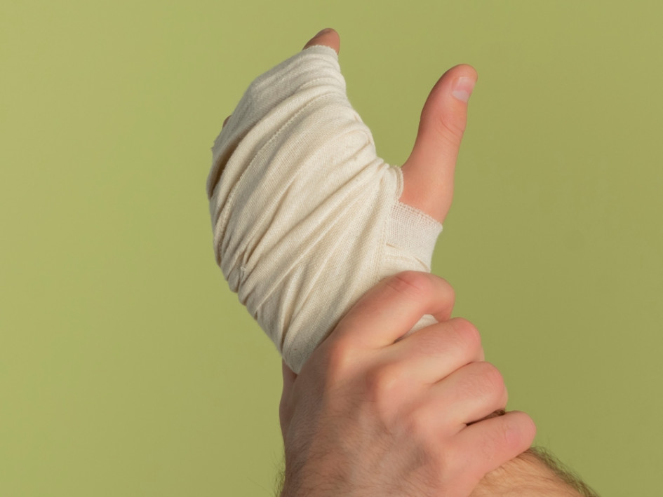 Quemado por pólvora Quemado por pólvora