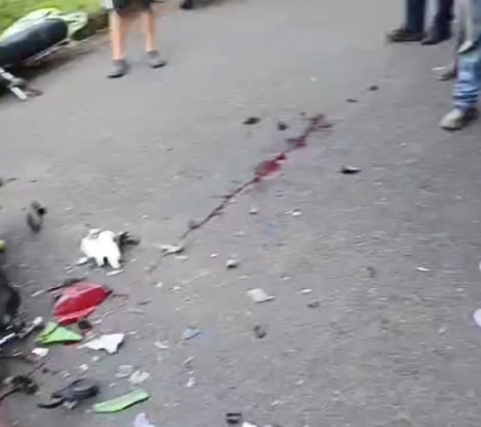 El conductor de una motocicleta, un adulto mayor, murió de manera instantánea, mientras el otro involucrado resultó con lesiones de consideración. El conductor de una motocicleta, un adulto mayor, murió de manera instantánea, mientras el otro involucrado resultó con lesiones de consideración.