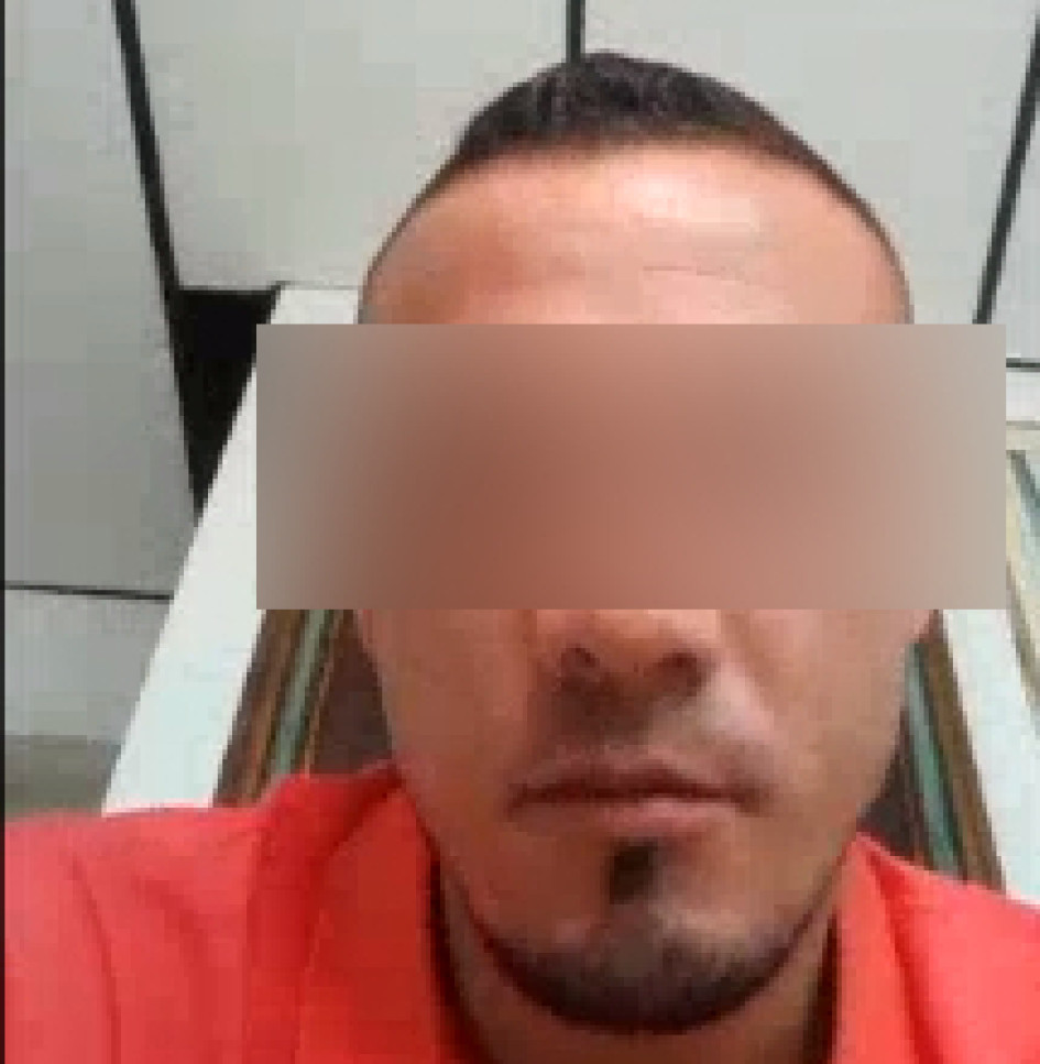 Galvis habría atacado a botellazos a un policía en Solferino. Galvis habría atacado a botellazos a un policía en Solferino.