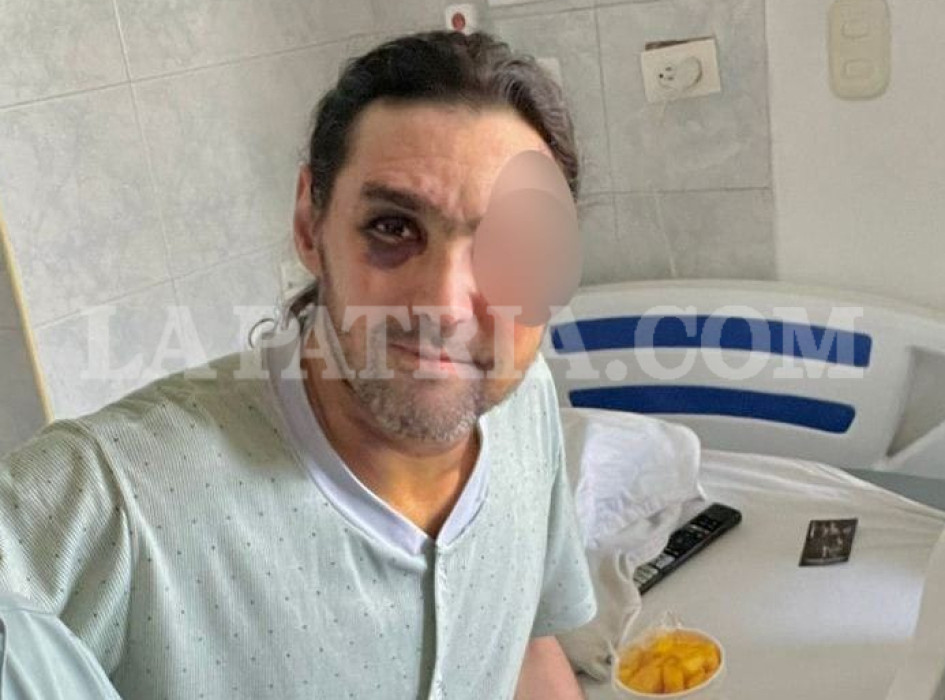 Gustavo Gil se recupera de las lesiones, aunque deben someterlo a una delicada cirugía para evitar que pierda la visión.
