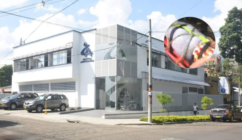 5 de los hinchas accidentados ya tienen el alta médica, uno espera evaluación de un especialista y otro esta en cuidados intensivos 