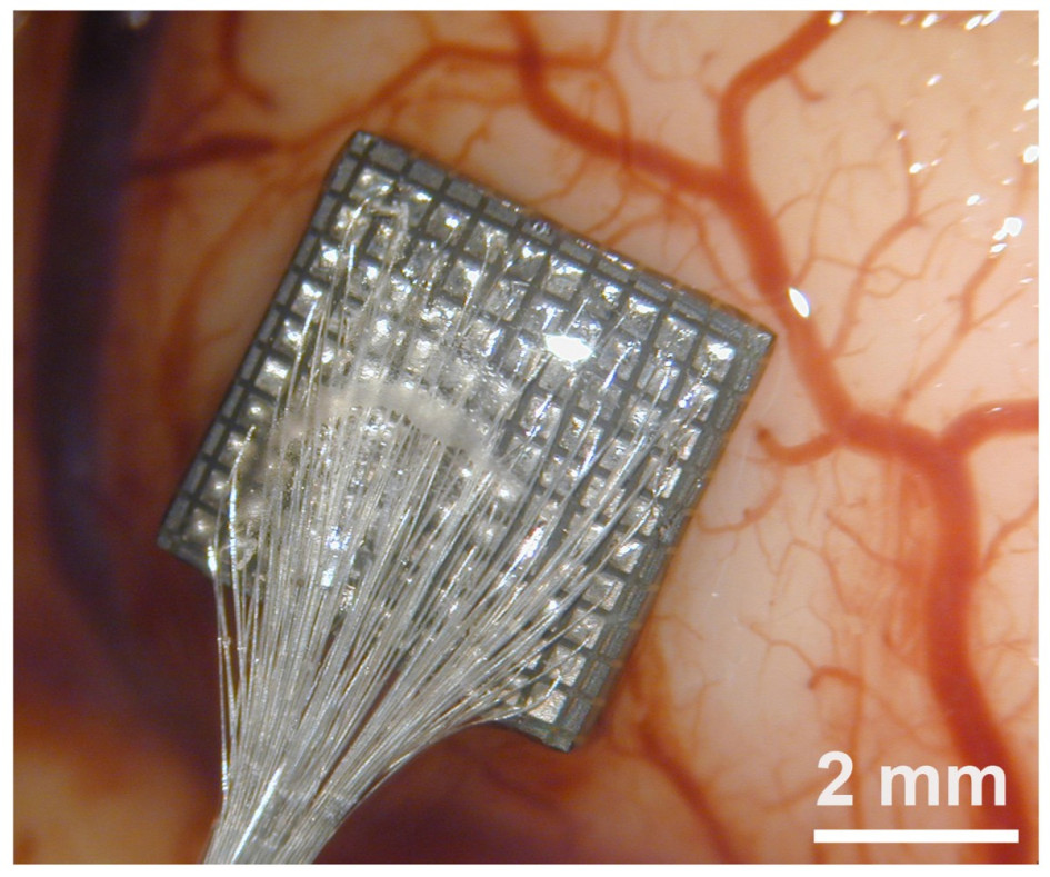 Matriz de 100 microelectrodos en la corteza cerebral humana.