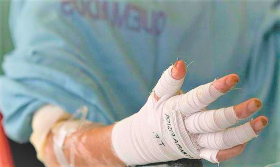 Una bengala, uno de los artefactos involucrados, puede causar graves quemaduras al contacto con la piel.