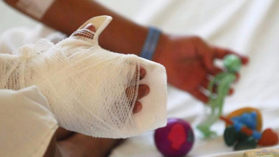 Quemados por pólvora