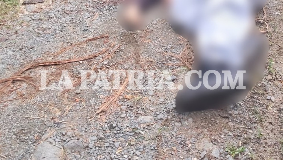 La víctima sería un joven, de 18 años, quien presentaba dos heridas provocadas supuestamente con arma de fuego.