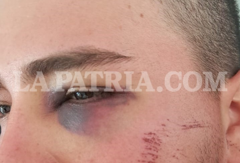 80 puntos de sutura, un ojo afectado y fracturas en el rostro, lo que sufrió el lesionado.